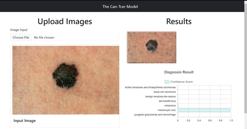 CanT-cer: Pioneering Skin Cancer Data Generation to Combat AI Bias